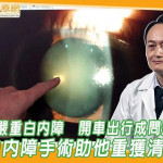 偏鄉翁罹嚴重白內障　開車出行成問題！微創白內障手術助他重獲清晰視力