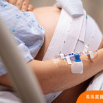 剖腹產半身麻醉4問