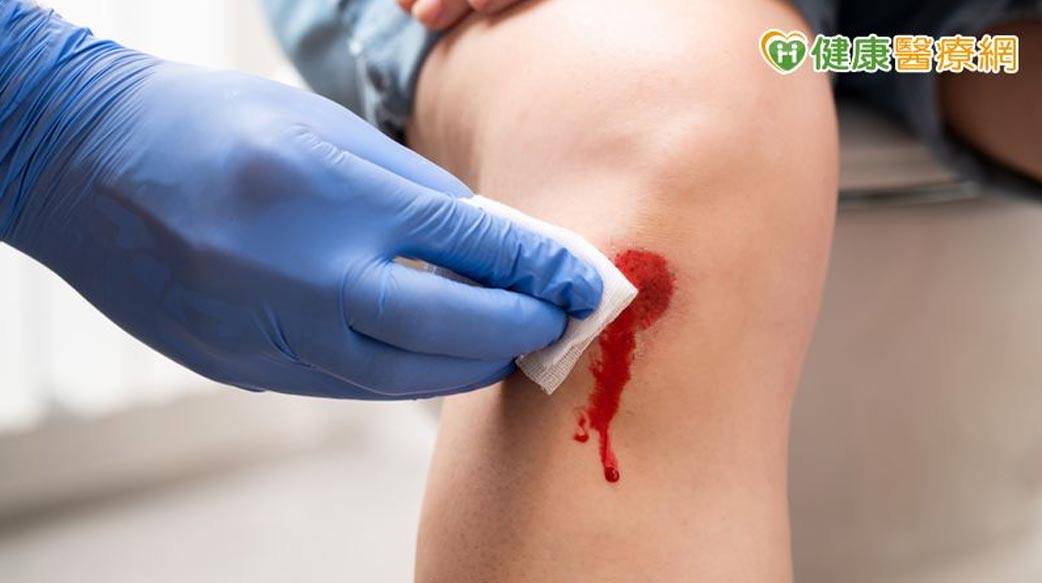 傷口照顧千萬別馬虎！　返家照護、敷料選擇、除疤撇步一次看