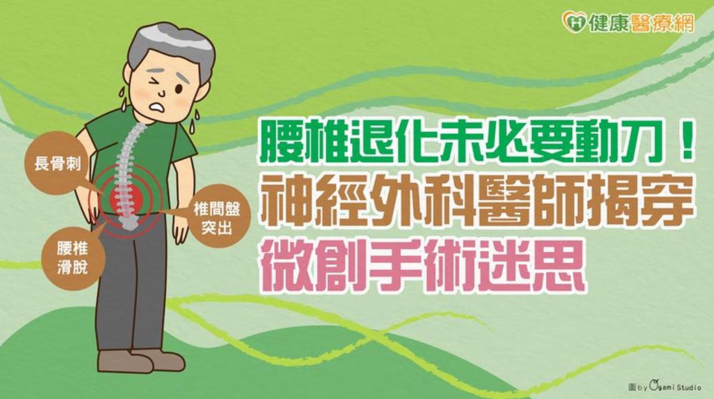腰椎退化未必要動刀！神經外科醫師揭穿微創手術迷思
