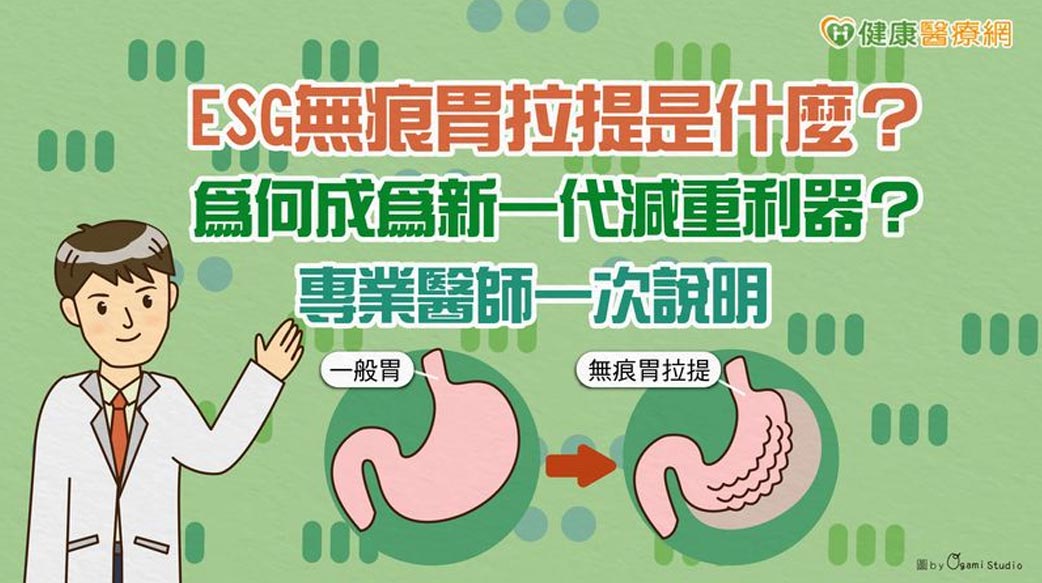 ESG無痕胃拉提是什麼？為何成為新一代減重利器？專業醫師一次說明