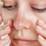 毛孔粗大怎麼改善？專家這樣建議