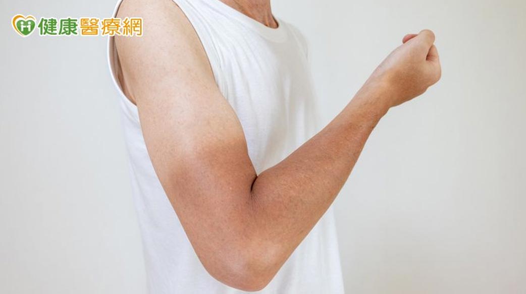 擦防曬乳還是照樣變黑？營養師：「熱」也會讓人變黑