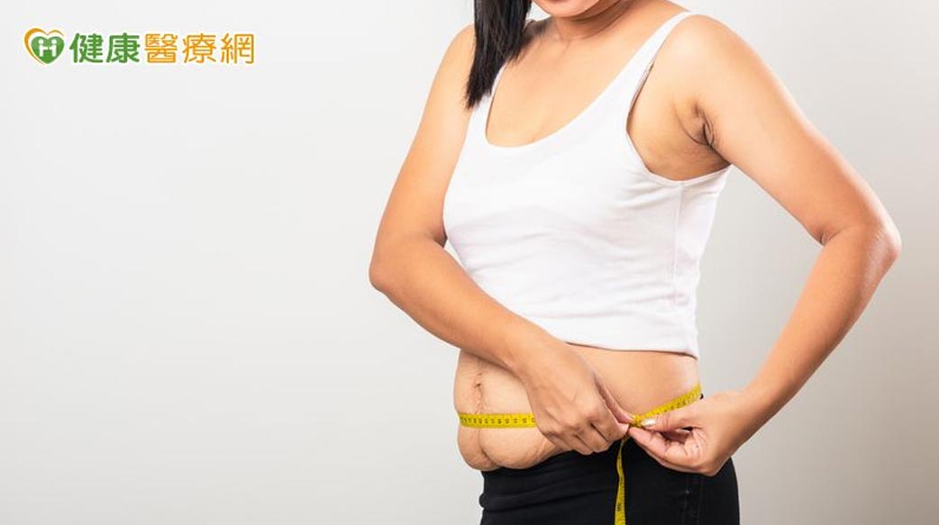 剖腹產傷口裂開、掉髮加劇？　中醫師提醒產後減重千萬別心急