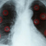 秋冬肺炎防护这样做