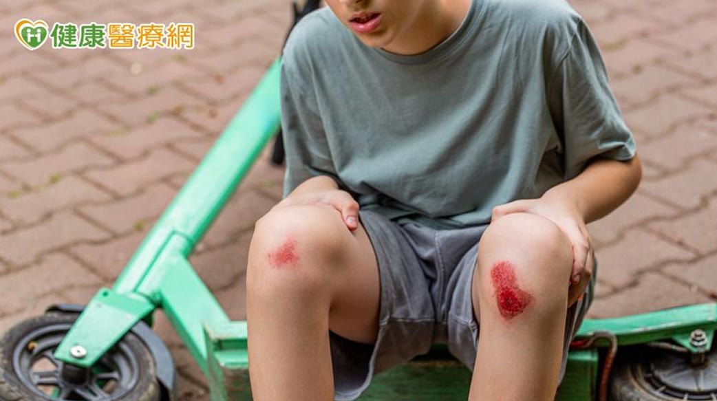 傷口癒合不是結束　預防疤痕從「這時機」開始！醫揭疤痕凝膠應用策略