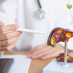 肝癌成國人第二大癌症殺手！真的罹癌該如何治療？這兩類人更需注意！