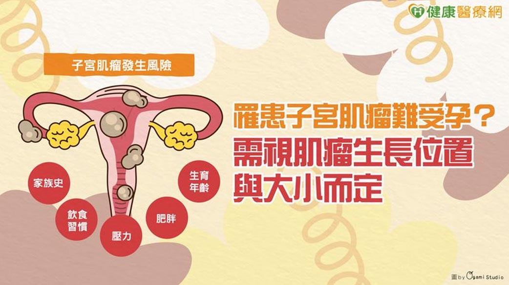 罹患子宮肌瘤難受孕？需視肌瘤生長位置與大小而定
