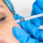 年前微整形疗程很夯，安全变美比速美更重要