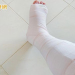 54歲男傷口反覆感染　歷經9個月治療確診「慢性難癒傷口合併骨髓炎」