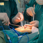 人老心臟瓣膜也「老」　醫籲4族群提高警惕！瓣膜置換時機、選項一次看